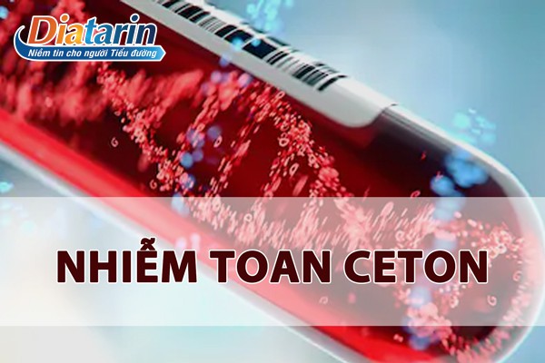 Nhiễm toan Ceton là một biến chứng cấp tính của bệnh đái tháo đường Type 2