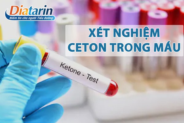 Xét nghiệm Ceton trong máu để chuẩn đoán